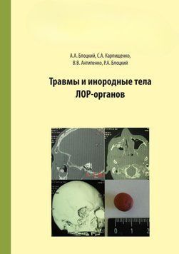 Травмы и инородные тела лор-органов 57113286 фото