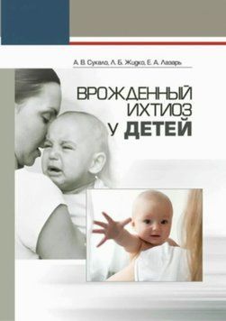 Врожденный ихтиоз у детей 7647410 фото
