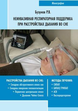 Неінвазивна респіраторна підтримка при розладах дихання уві сні 48484536 фото