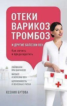 Отеки, варикоз, тромбоз и другие болезни вен. Как лечить и предотвратить 24574 фото