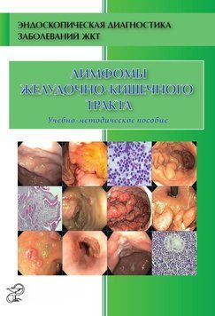 Лимфомы желудочно-кишечного тракта 52232809 фото