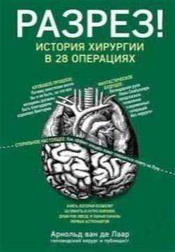 Розріз! Історія хірургії у 28 операціях 217610 фото