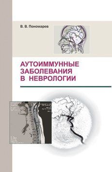Аутоиммунные заболевания в неврологии 7060762 фото