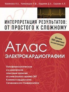 Атлас электрокардиографии. Интерпретация результатов: от простого к сложному 642 фото
