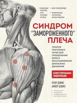 Синдром &laquo;замороженного&raquo; плеча. Терапия триггерных точек для преодоления боли и восстановления диапазона движений 423722 фото