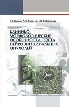 Клініко-морфологічні особливості росту нейроепітеліальних пухлин 7068646 фото