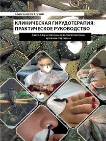 Клиническая гирудотерапия: практическое руководство. Книга 2 Приставочные и постприставочные процессы. Гирудиноз # 14151 фото