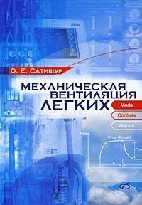 Механічна вентиляція легень 4693 фото