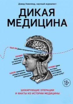 Дика медицина. Шокуючі операції та факти з історії медицини 214464267839 фото