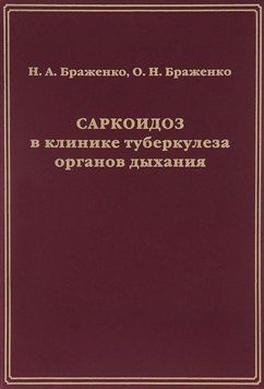 Саркоидоз в клинике туберкулеза органов дыхания 34332590 фото